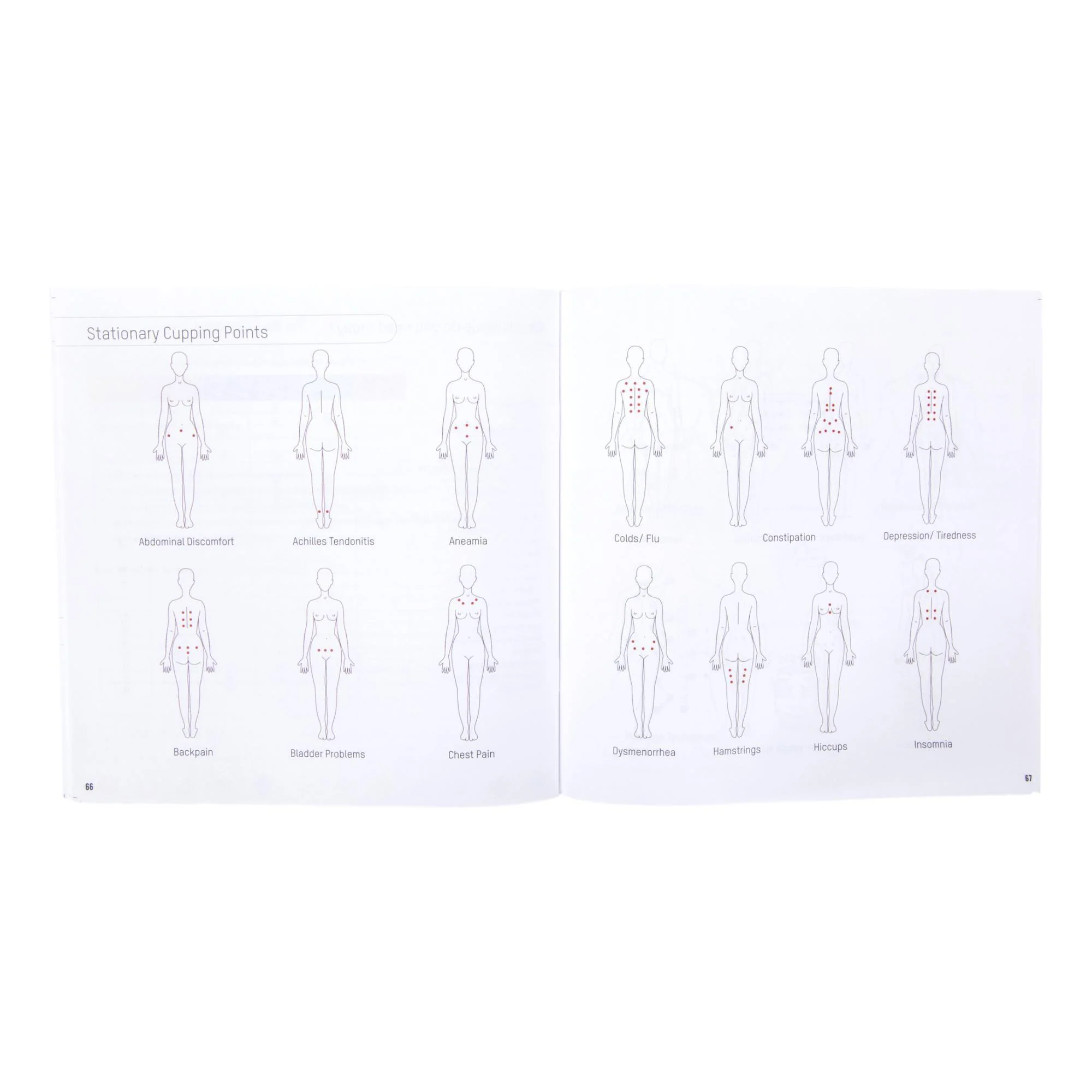 Bellabaci Professional Therapist Cupping Kit - Image 14