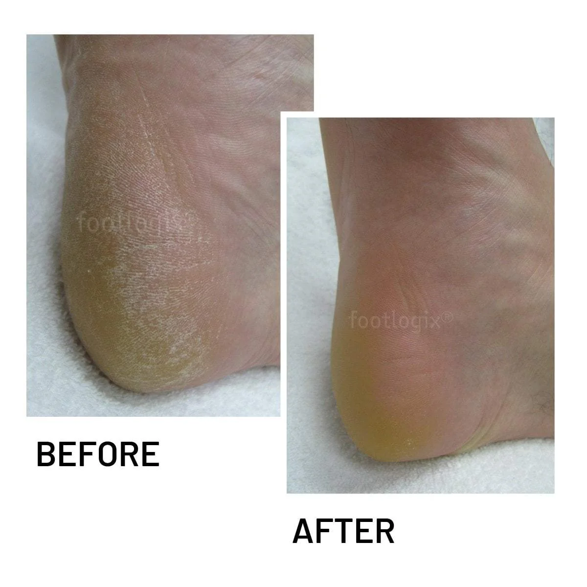 Footlogix Cracked Heel Formula, 4.2 oz - Image 3