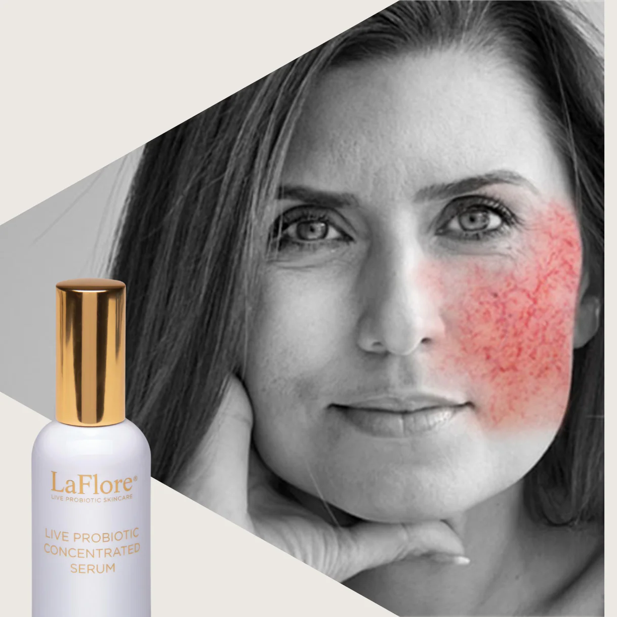 LaFlore Live Probiotic Concentrated Serum - Image 2