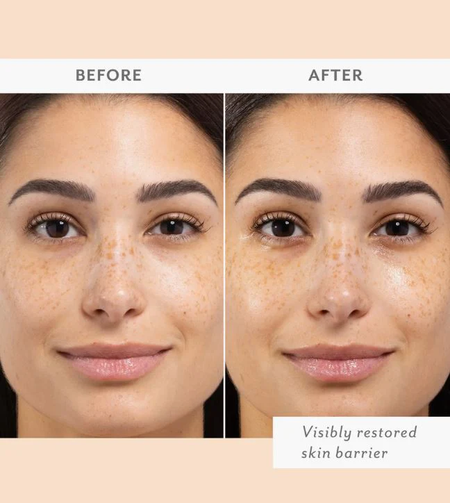 Patchology Skin Remedy Barrier-Boosting Sheet Mask, 1 ct - Image 4