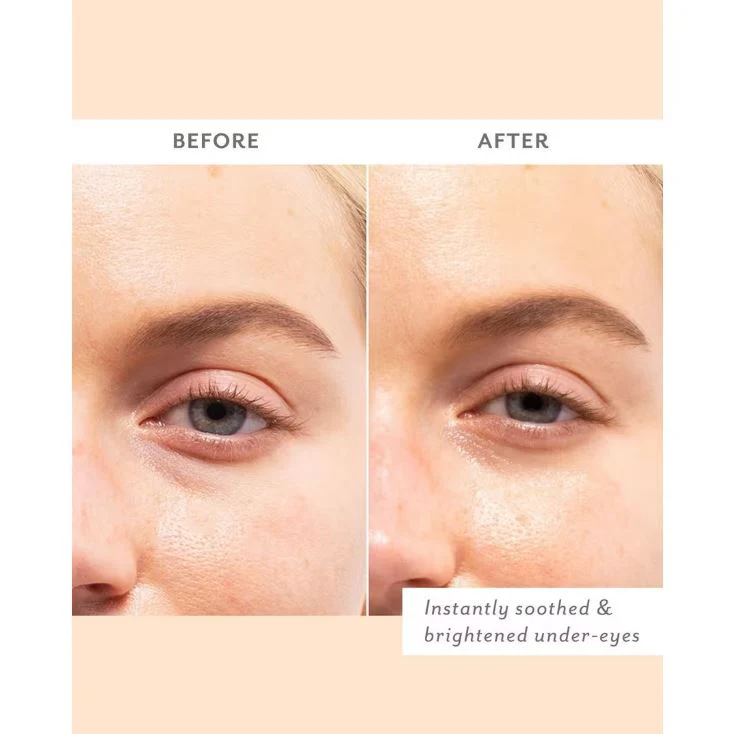Patchology Skin Remedy Soothing Eye Gels - Image 5